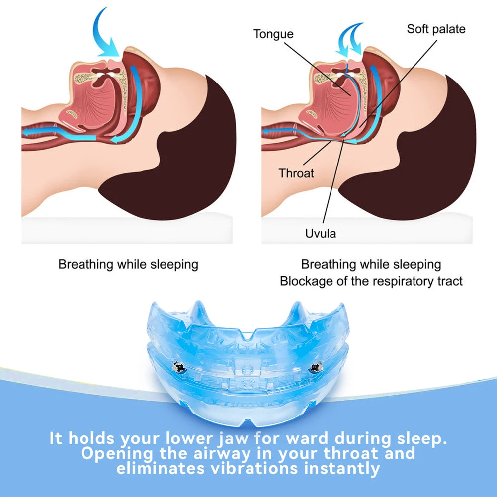 Adjustable Anti Snoring Mouth Guard