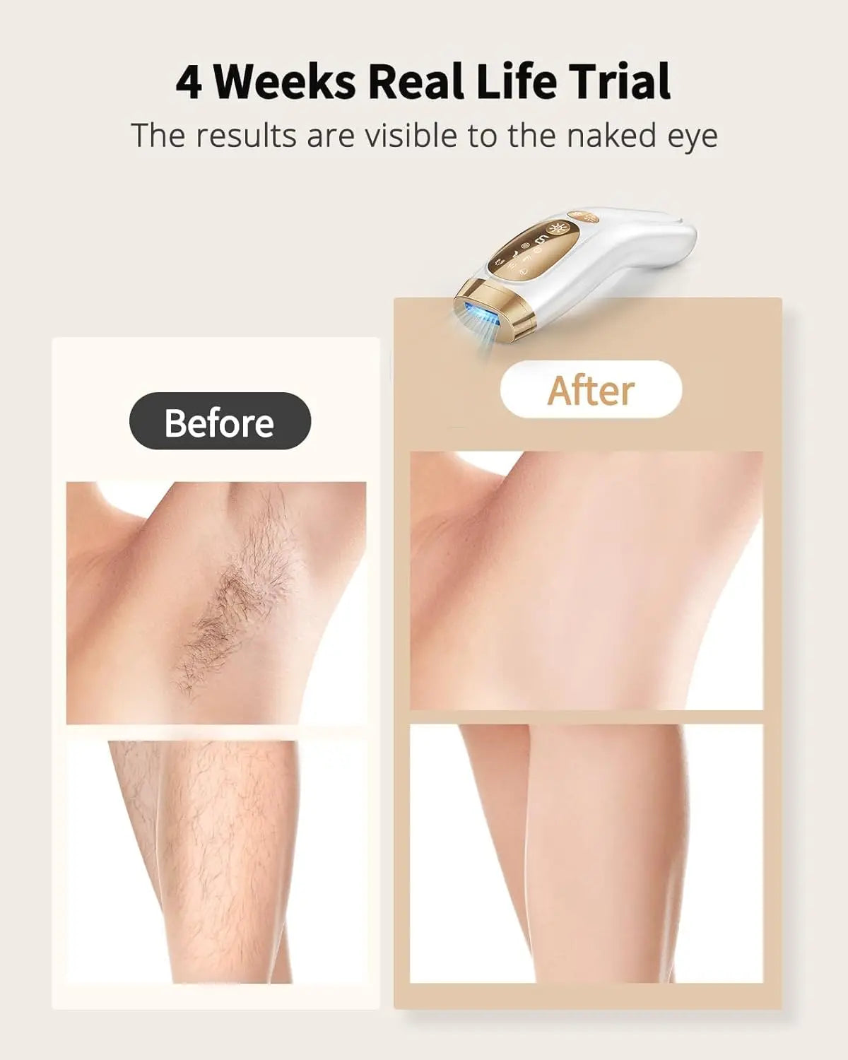 IPL Hair Removal Unlimited Flashes Laser Ice-Cooling Painless Whole Body Treament Safe